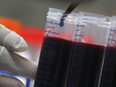 Θερίζει το AIDS σε Ευρώπη και Ασία