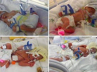 Γέννησε τετράδυμα… εν αγνοία της