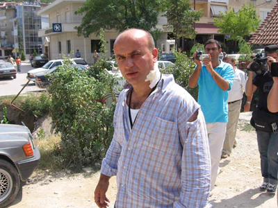 Εκατομμυριούχος επιτέθηκε σε δημοσιογράφο