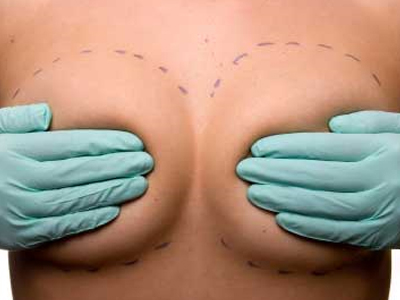 Μαζί με το διαζύγιο, ζήτησε και τα εμφυτεύματα σιλικόνης!