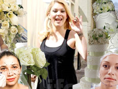 Γάμος+πλαστικές= Νέο ριάλιτι