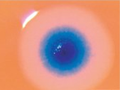 Αμηχανία στους Καθολικούς για την “τεχνητή ζωή”