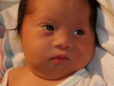 Ξέχασαν να τους πουν… για το σύνδρομο Down