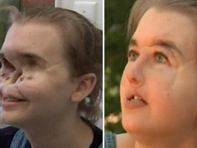 Ξανακέρδισε τη ζωή….