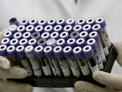 Γιατρός μετέδωσε ηπατίτιδα σε ασθενείς του