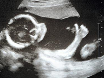 “ΟΚ” από τον υπέρηχο