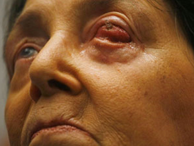 Βλέπει με το δόντι της!