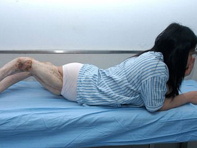 Της γύρισαν τα πόδια… ανάποδα