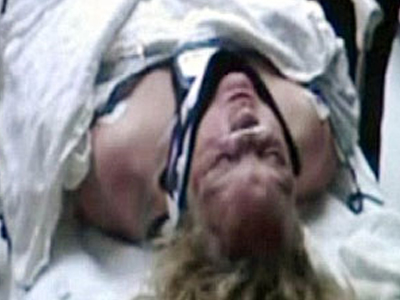 Επέζησε πίνοντας νερό από τα μαλλιά της