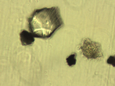 Επικίνδυνη για την υγεία η ηφαιστειακή σκόνη