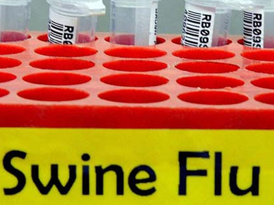 Ο πρώτος θάνατος από νέα γρίπη στη Γερμανία