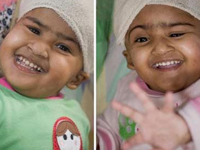 Καλά στην υγεία τους τα σιαμαία