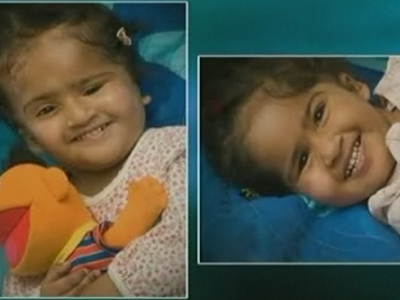 Νέα ζωή για τα σιαμαία κορίτσια