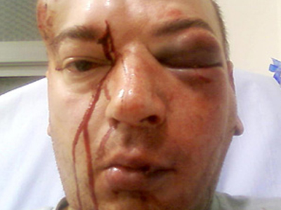 Πήγε να βοηθήσει και κατέληξε στα “επείγοντα”