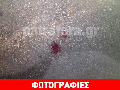 Πάτρα: Αυτοκίνητο παρέσυρε και τραυμάτισε ηλικιωμένο