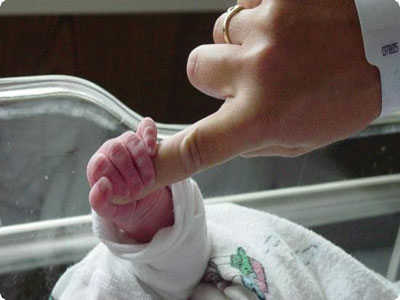 Πρόωρος τοκετός: Νο1 αιτία της παιδικής θνησιμότητας