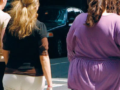 Αυστραλία: Να ενταχθεί στο δημόσιο σύστημα υγείας η επέμβαση βάρους