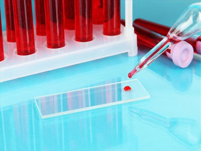 Τεστ αίματος προβλέπει πόσο γρήγορα θα αναρρώσει ο ασθενής