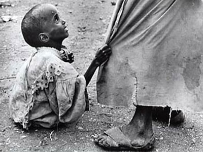 Σομαλία: 38.000 παιδιά κινδυνεύουν να πεθάνουν από την πείνα