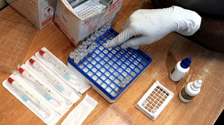 Βρετανία: Διατίθενται μέσω διαδικτύου τεστ αυτοδιάγνωσης του AIDS