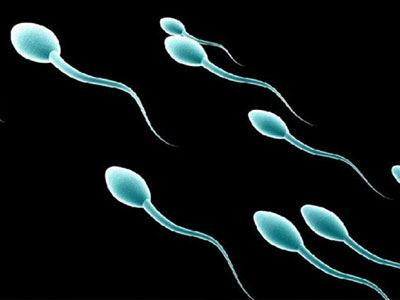 Το μήκος των σπερματοζωαρίων μπορεί να σχετίζεται με προβλήματα γονιμότητας