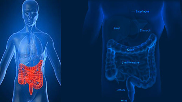Καρκίνος του παχέος εντέρου: Πώς να προφυλαχθείτε