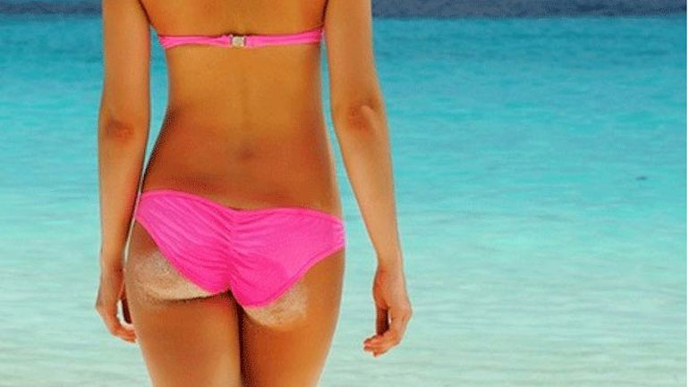 Έξυπνα tips για την καταπολέμηση της κυτταρίτιδας