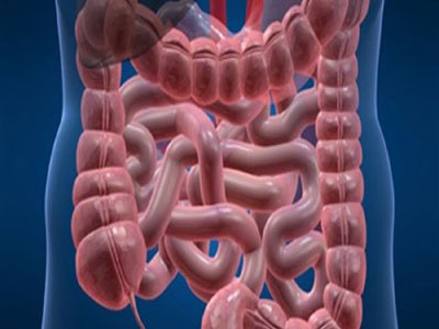 Αυξάνονται τα περιστατικά καρκίνου του παχέος εντέρου