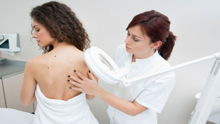 Αύξηση των μελανωμάτων στους νέους – Δωρεάν εξετάσεις