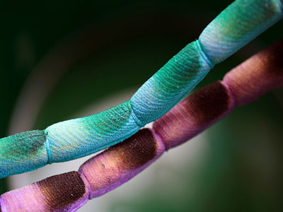 Νέα μέθοδος δημιουργίας βλαστοκυττάρων