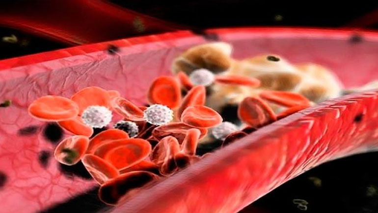 Καμπάνια ενημέρωσης για τη δυσλιπιδαιμία