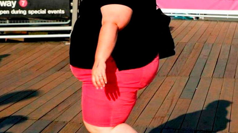 Οι παχύσαρκες γυναίκες κινδυνεύουν περισσότερο από καρκίνο του μαστού