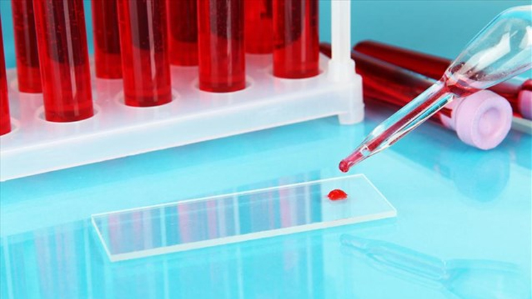 Τεστ αίματος υπολογίζει πόσο γρήγορα γερνάει το σώμα μας