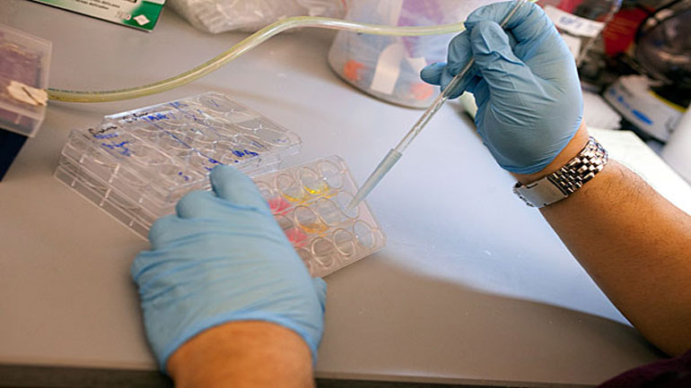 Θεσσαλονίκη: Δωρεάν εξετάσεις για καρκίνο του παχέος εντέρου