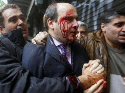 Προκαταρκτική εξέταση για την επίθεση κατά του Κωστή Χατζηδάκη