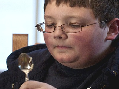 Η παιδική παχυσαρκία συνδέεται με καρδιολογικά προβλήματα Η παιδική παχυσαρκία συνδέεται με καρδιολογικά προβλήματα