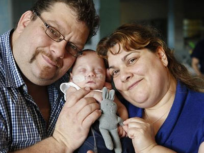 Παιδί Ελλήνων μεταναστών γεννήθηκε μόλις 395 γραμμάρια