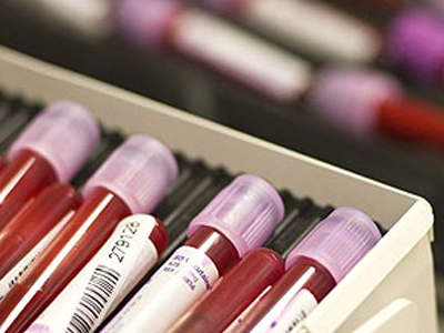 Επείγουσα έρευνα  από το Υπουργείο Υγείας για το πλάσμα αίματος