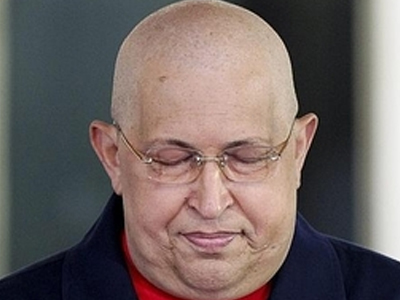 Chavez: Αναρρώνει με ταχύ ρυθμό
