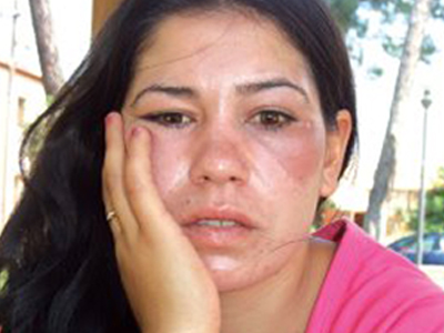 Ξυλοφόρτωνε τη μάνα των παιδιών του