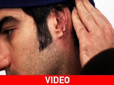 Τρεις «μαυροντυμένοι» μου έκοψαν με τα δόντια τους το αυτί μου Τρεις «μαυροντυμένοι» μου έκοψαν με τα δόντια τους το αυτί μου