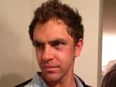 ΗΠΑ: Αστυνομικοί χτύπησαν κωφό γιατί νόμιζαν ότι τους κορόιδευε