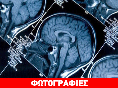 Πως ο εγκέφαλος του Σουμάχερ επηρεάστηκε από το χτύπημα