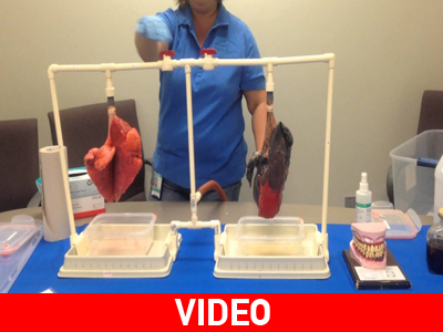 Ετσι είναι οι πνεύμονες όσων καπνίζουν