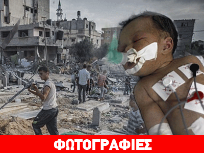 Μάχη για να κρατηθεί στη ζωή δίνει το μωρό-θαύμα της Γάζας