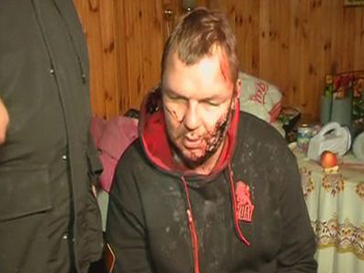 Ο ουκρανός ακτιβιστής που βασανίστηκε μπορεί να νοσηλευτεί στην ΕΕ δηλώνει ο γερμανός ΥΠΕΞ