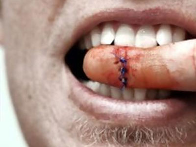 Ηλεία: Υποψήφιος τοπικός σύμβουλος δάγκωσε ψηφοφόρο «για ένα καλαμπούρι» Ηλεία: Υποψήφιος τοπικός σύμβουλος δάγκωσε ψηφοφόρο «για ένα καλαμπούρι»