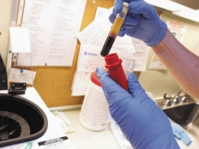 Παγκόσμιο πρόβλημα οι ιογενείς ηπατίτιδες