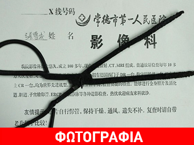 Του έκλεψε το μπέικον, τον κυνήγησε και κατέληξε με μια λαβίδα στο κεφάλι Του έκλεψε το μπέικον, τον κυνήγησε και κατέληξε με μια λαβίδα στο κεφάλι