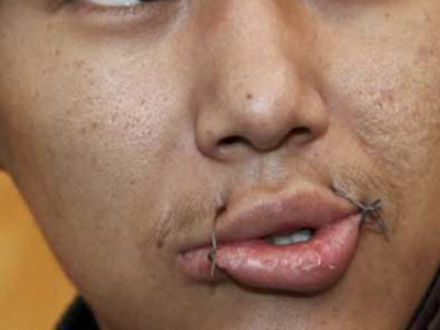 Έραψαν το στόμα τους σε ένδειξη διαμαρτυρίας